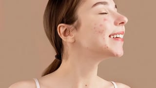 diseased skin volunteer